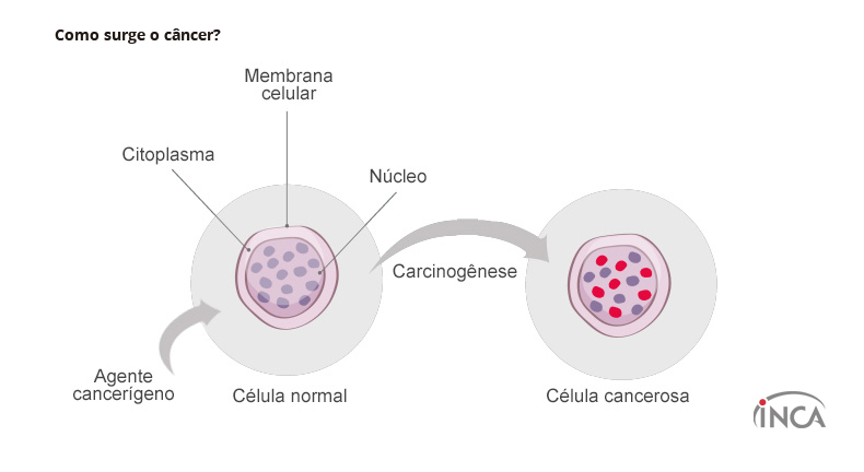 Como surge o câncer? | INCA - Instituto Nacional de Cáncer