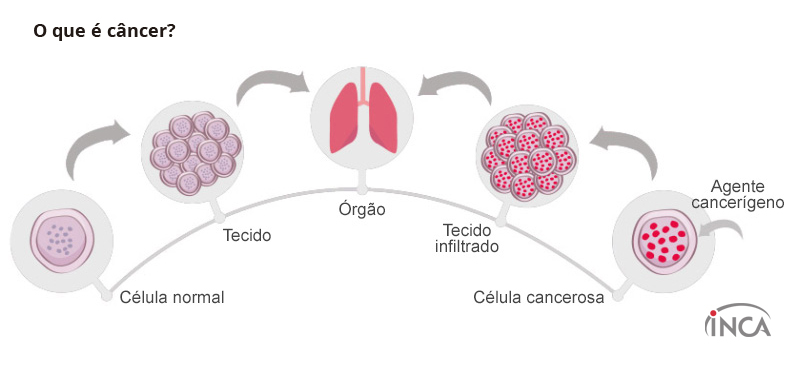 Resultado de imagem para câncer